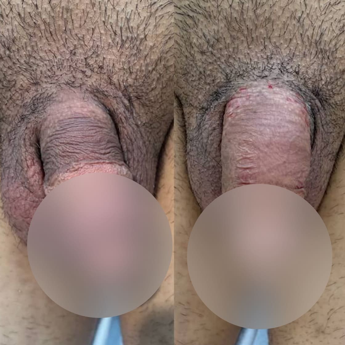 Dr. Eudes Pinheiro -www.dreudespinheiro.com.br - Imagem - 0001