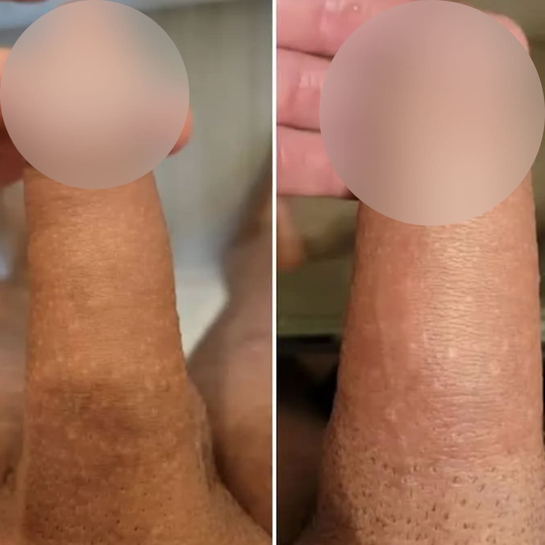 Dr. Eudes Pinheiro -www.dreudespinheiro.com.br - Imagem - 0003