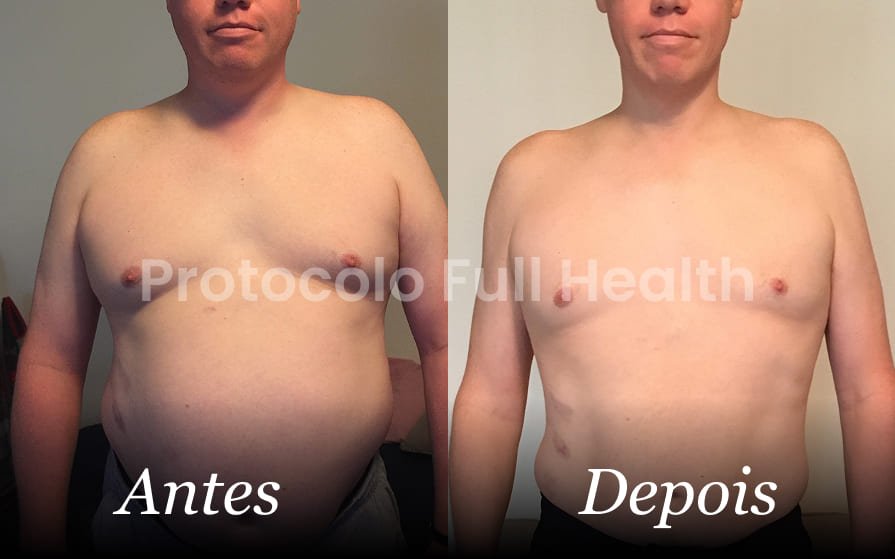 Antes e depois - 01