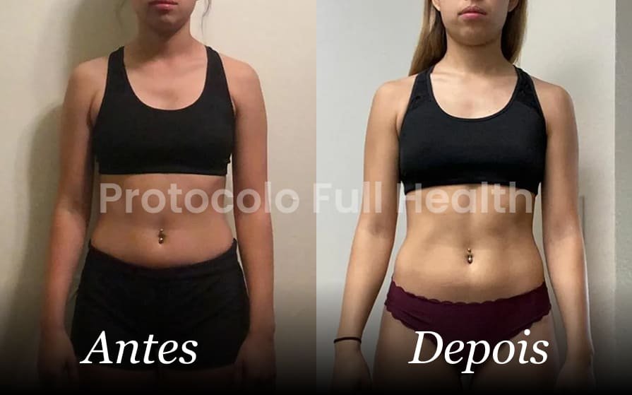 Antes e depois - 4